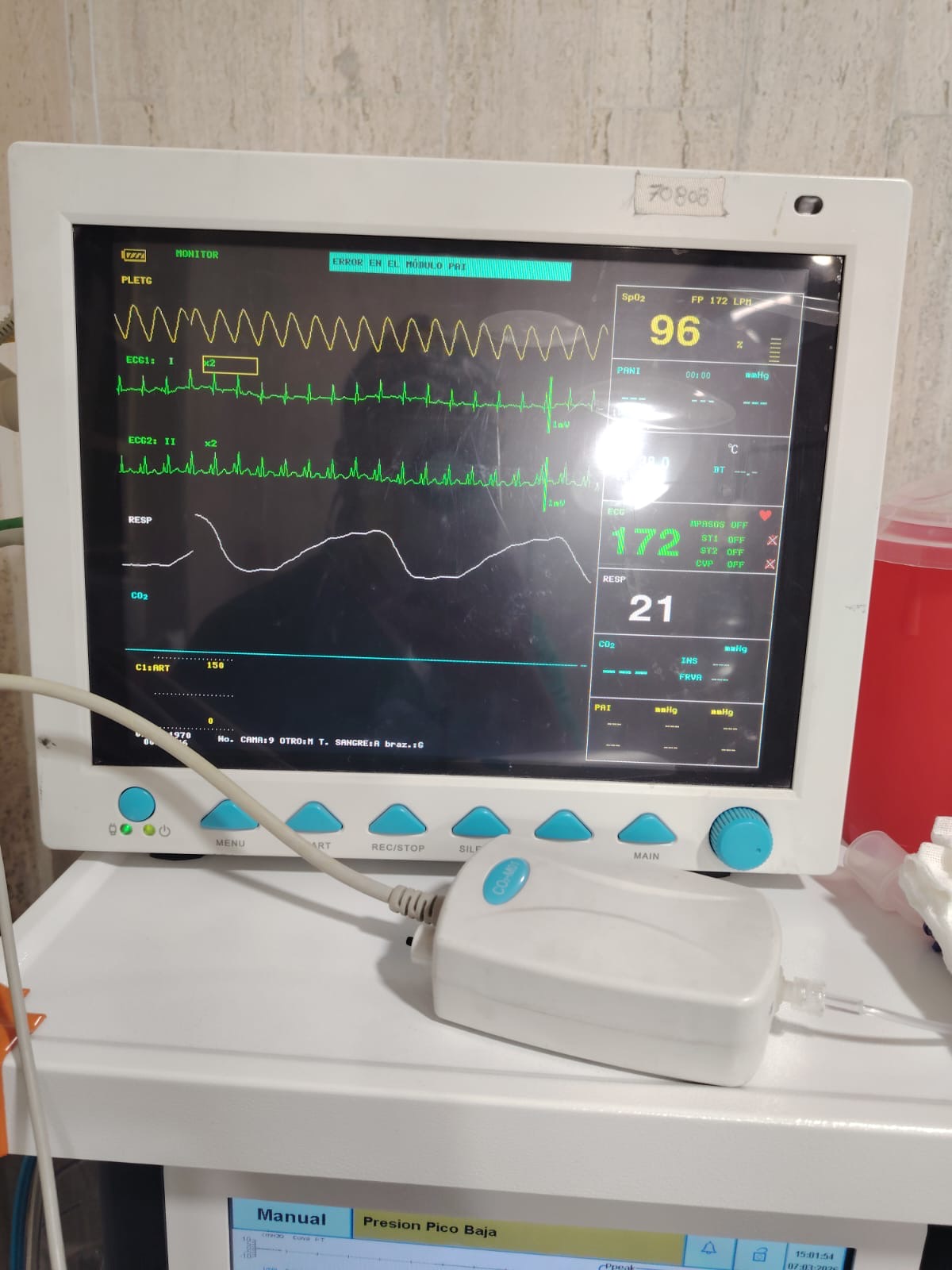 Monitor médico veterinario